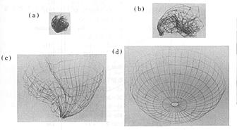 Ni-Ti (shape-memory alloys)